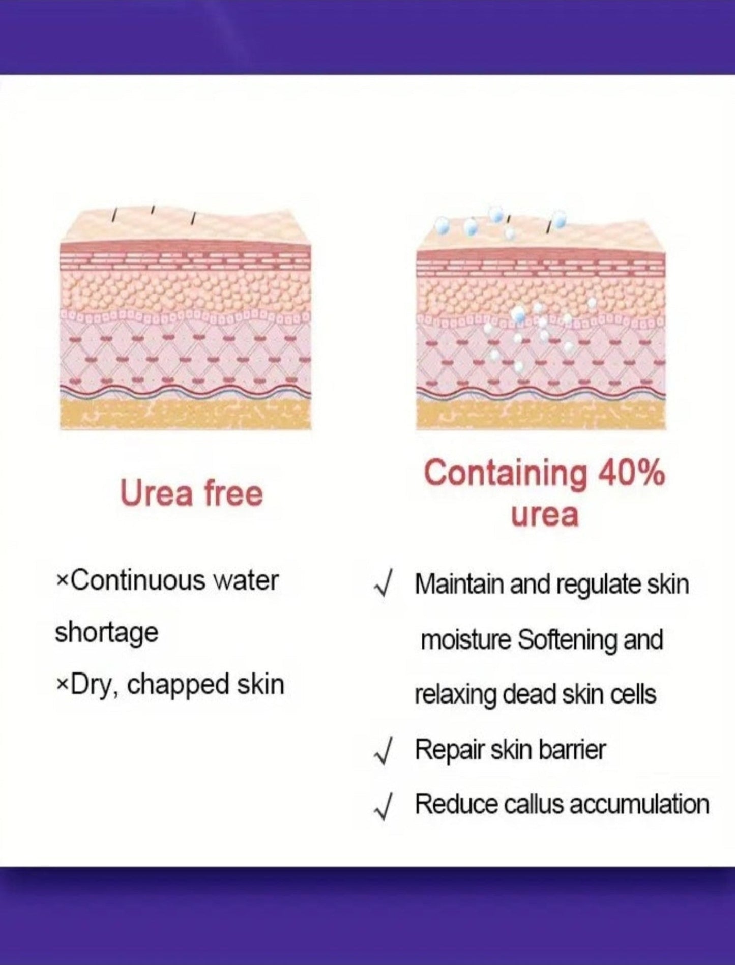 dermfree urea cream with and without urea diagram