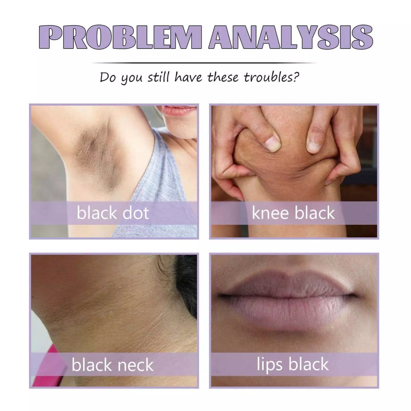 vitacosmox dark spot corrector cream problem analysis