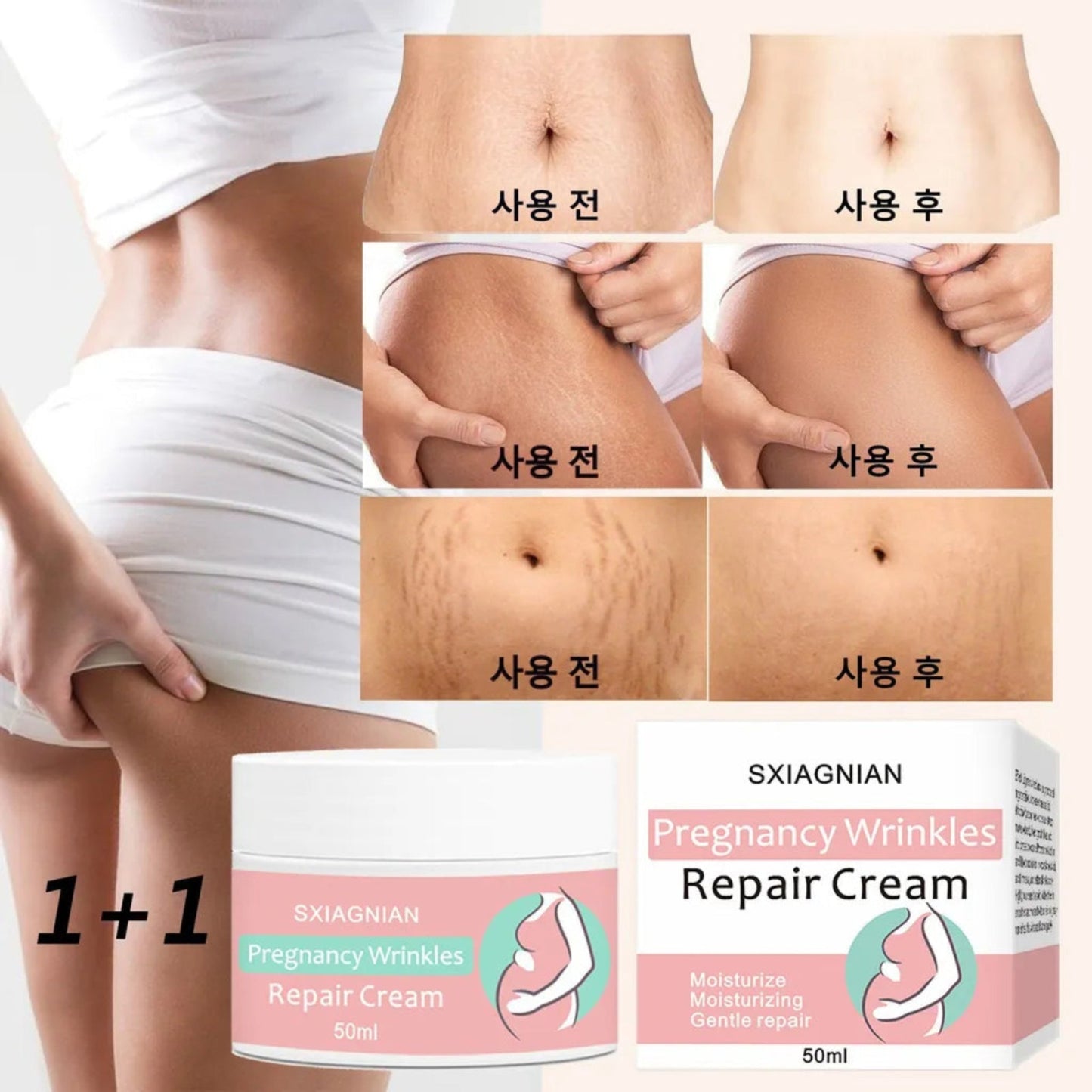 vitacosmox stretch cream before and after - 1 + 1 pack