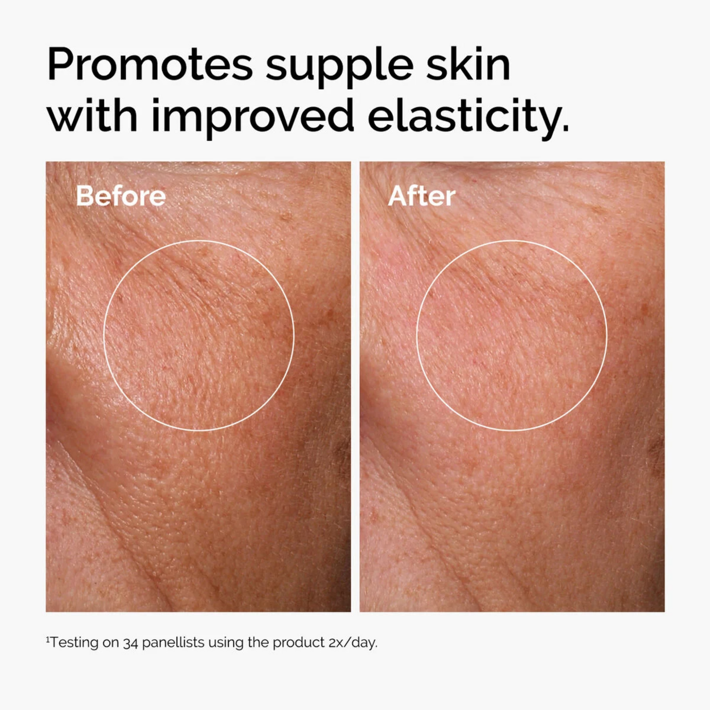 ordinary hyaluronic acid before and after